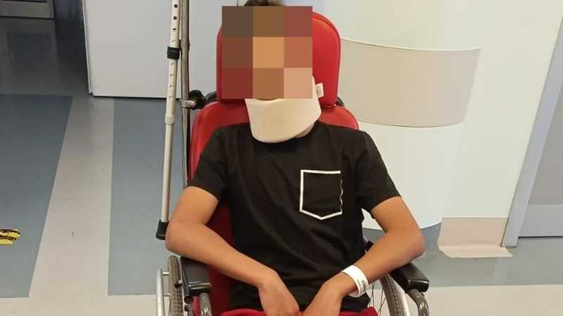 Goleiro sub-14 é agredido por pai de adversário e sofre fratura, traumatismo e hematomas