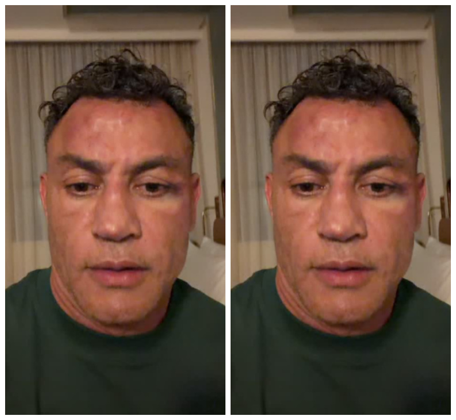 Popó chama Werdum de covarde após confusão que deixou Wanderlei Silva desacordado