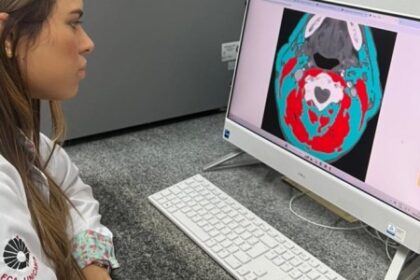 Como Gordura e Massa Muscular Contribuem para a Sobrevida de Pacientes com Câncer de Cabeça e Pescoço