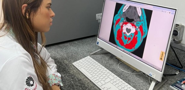 Como Gordura e Massa Muscular Contribuem para a Sobrevida de Pacientes com Câncer de Cabeça e Pescoço