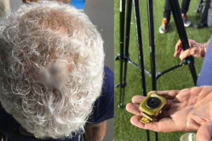 Cinegrafista da TV Bahia sofre ferimento na cabeça após ser atingido por relógio no Ba-Vi