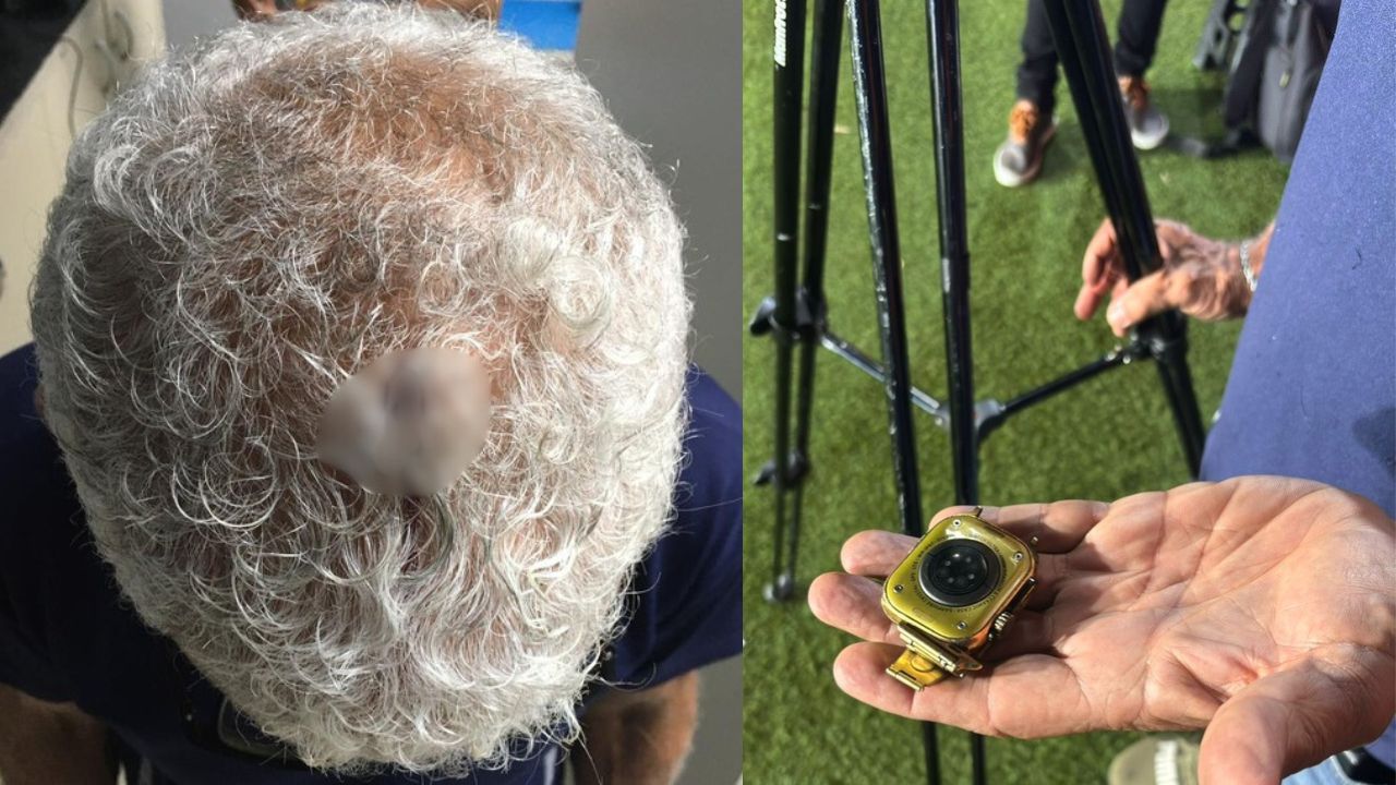Cinegrafista da TV Bahia sofre ferimento na cabeça após ser atingido por relógio no Ba-Vi