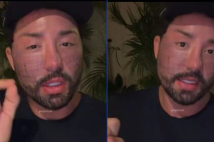 Rico Melquiades: Cirurgia Revelada para Ficar 'Mais Apertado'