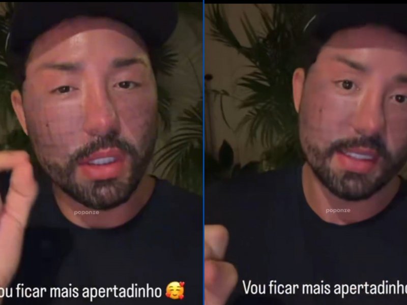 Rico Melquiades: Cirurgia Revelada para Ficar 'Mais Apertado'