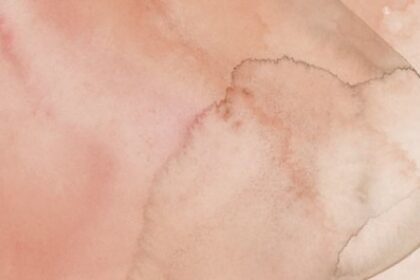 Estudo Brasileiro Revela Como Alguns Tipos de Câncer de Mama Evitam Tratamentos