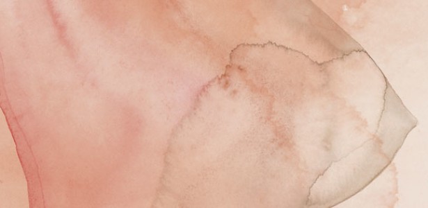 Estudo Brasileiro Revela Como Alguns Tipos de Câncer de Mama Evitam Tratamentos