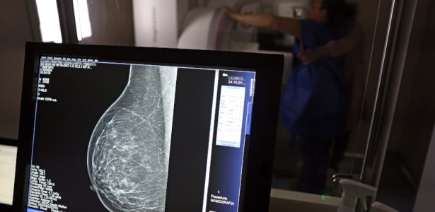 Como Medo, Dor e Desigualdade Impedem o Rastreamento do Câncer de Colo do Útero e Mama entre Mulheres