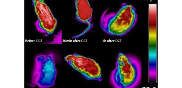 Descoberta: Conjunto de Neurônios Ligado à Febre e Torpor