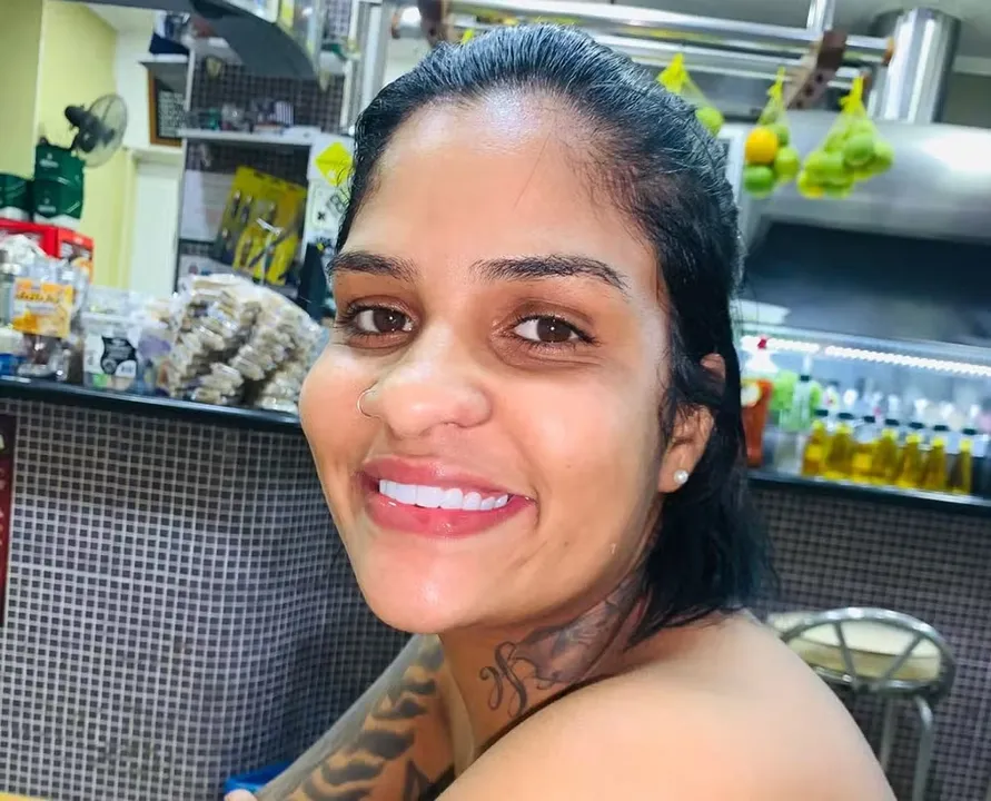 Vítima de atropelamento na Marginal Tietê enfrentará nova amputação