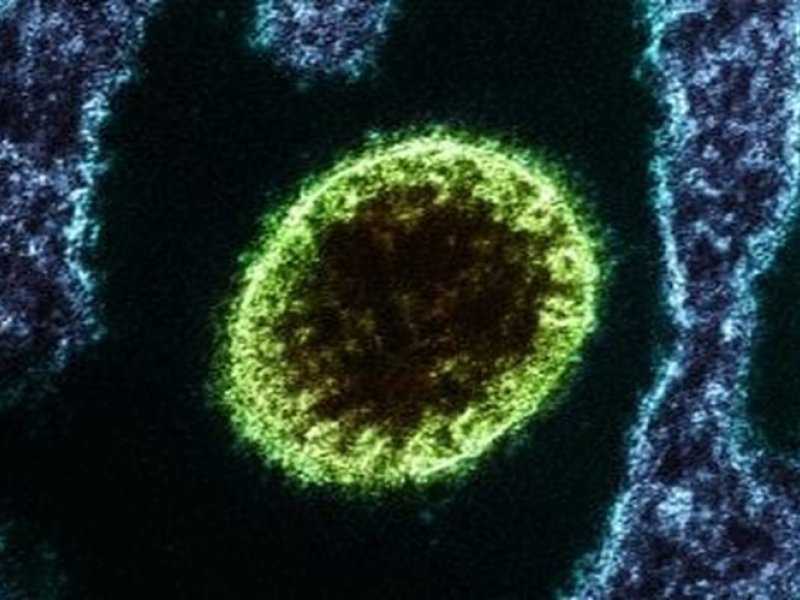 Índia confirma: 100 em quarentena por vírus Nipah — o que está por trás?
