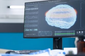 Neuromodulação e Fisioterapia: Estratégias Inovadoras para Reabilitação de Pacientes Pós-AVC