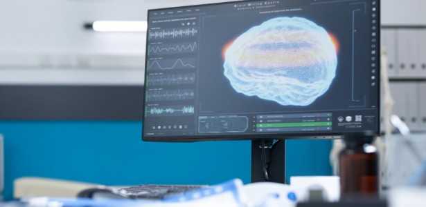 Neuromodulação e Fisioterapia: Estratégias Inovadoras para Reabilitação de Pacientes Pós-AVC