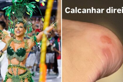 Virginia Revela Machucados Após Ensaio na Sapucaí: 'Não Consigo Andar'