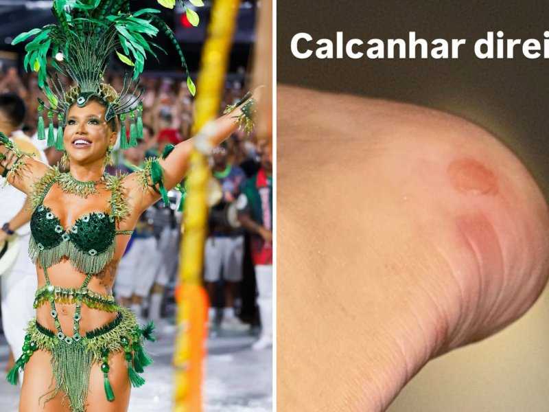 Virginia Revela Machucados Após Ensaio na Sapucaí: 'Não Consigo Andar'