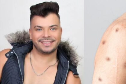 Fotos de cantor paraense que faleceu por Mpox viralizam na semana em que Brasil registra 90 casos