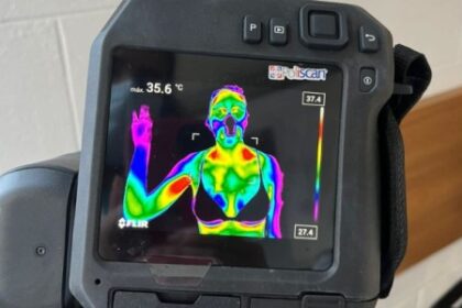 Efeito Sanfona: Como Afeta o Metabolismo e Diminui a Atividade da Gordura Marrom em Mulheres