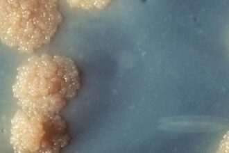 Nanopartículas de Ferro Eliminam Tuberculose em Camundongos: Potencial para Novos Tratamentos