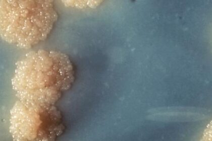 Nanopartículas de Ferro Eliminam Tuberculose em Camundongos: Potencial para Novos Tratamentos