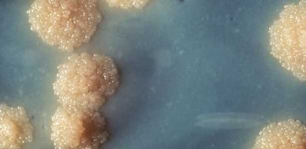 Nanopartículas de Ferro Eliminam Tuberculose em Camundongos: Potencial para Novos Tratamentos