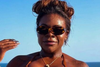 Jojo Todynho: Cirurgia no Nariz para uma 'Levantadinha' Surpreendente!