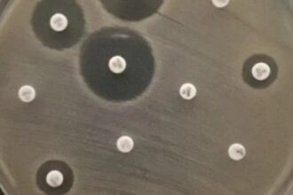 Bactérias Multirresistentes Encontradas em Rio Urbano, Cães e Lesões de Pele: Riscos à Saúde