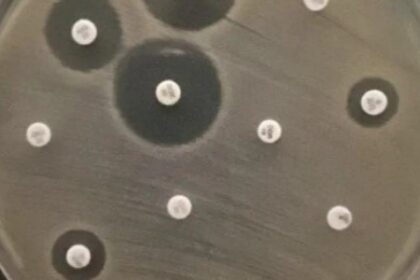 Bactérias Multirresistentes Encontradas em Rio Urbano, Cães e Lesões de Pele: Riscos à Saúde