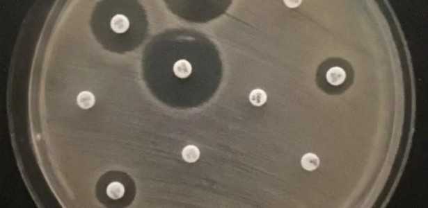 Bactérias Multirresistentes Encontradas em Rio Urbano, Cães e Lesões de Pele: Riscos à Saúde