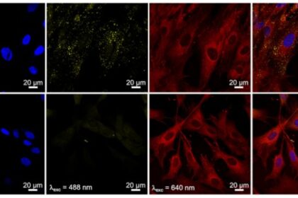 Avanço em Imagem Biomédica Potencializa Tratamento de Câncer, Revelam Pesquisadores