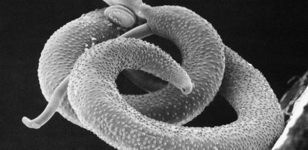 Pesquisa Identifica Alvos Genéticos Promissores no Combate à Esquistossomose