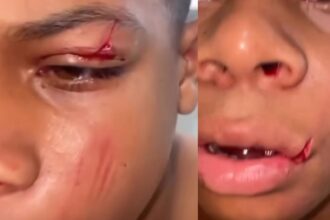 Aluno de 11 anos desmaia após agressão em escola de Camaçari