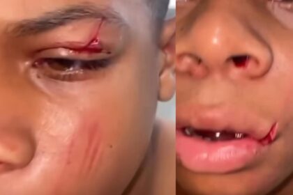 Aluno de 11 anos desmaia após agressão em escola de Camaçari