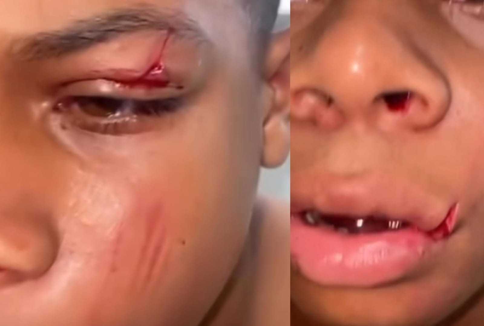 Aluno de 11 anos desmaia após agressão em escola de Camaçari