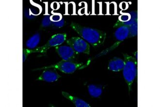CNPEM Revela Novos Avanços na Compreensão de Transtornos do Neurodesenvolvimento