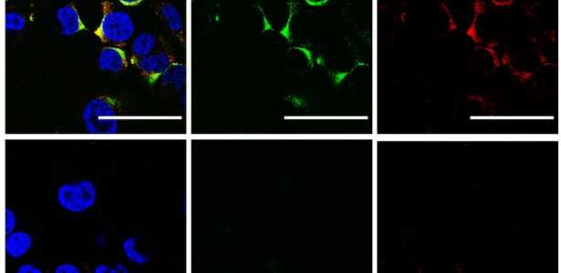 Ultrassom: A Nova Tecnologia para Combater os Vírus da Influenza A e COVID-19 sem Atingir Células Humanas
