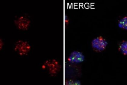 Descoberta de Proteína que Protege Células de Defesa: Estudo Revela Função Crucial