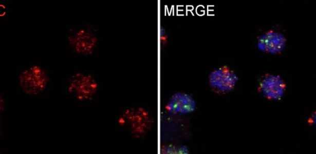 Descoberta de Proteína que Protege Células de Defesa: Estudo Revela Função Crucial
